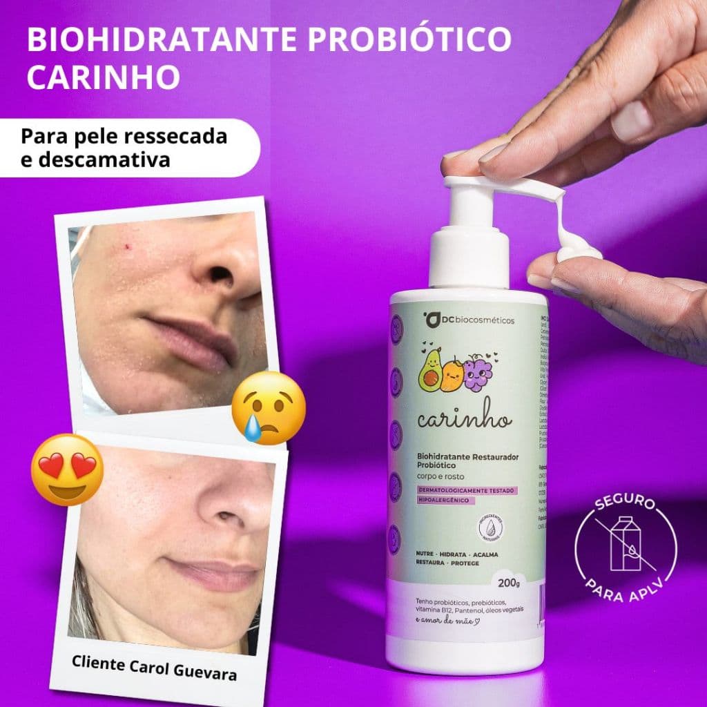 Hidratante Natural Probiótico - Corpo & Rosto | Dermatite Controlada