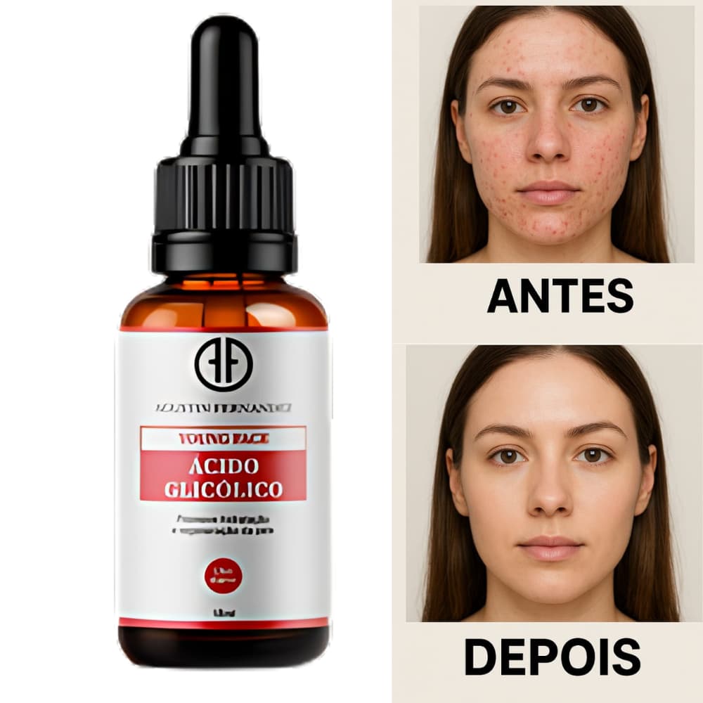 Sérum Ácido Glicólico 18ml – Renovação da Pele, Clareador, Anti-Idade , Anti-Manchas e Anti-Acne