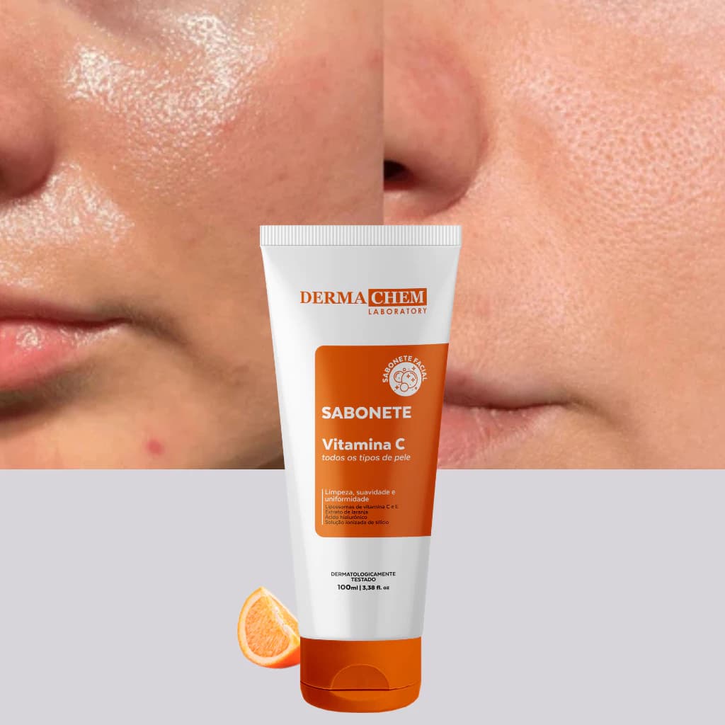Sabonete Vitamina C+e Anti Idade Clareador Dermachem 100ml