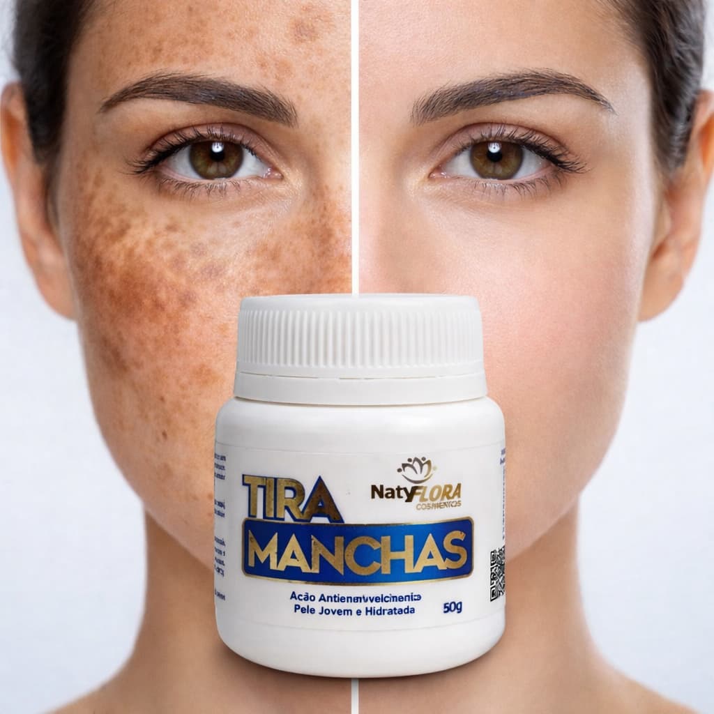 Creme Tira Manchas Facial Melasma Clareador Anti-idade Pele Uniforme Natyflora 50g