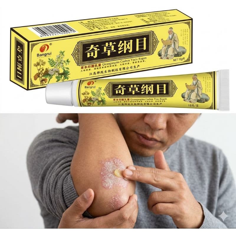 Creme Psoríase kit 3 Cremes Combate Coceira Alivia Vermelhidao Urticária Antibacteriano  Original