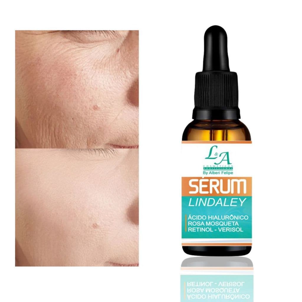 Sérum Lindaley Rico em Ácido Hialurônico / Retinol - Verisol / Rosa Mosqueta Antioxidante Vitamina C