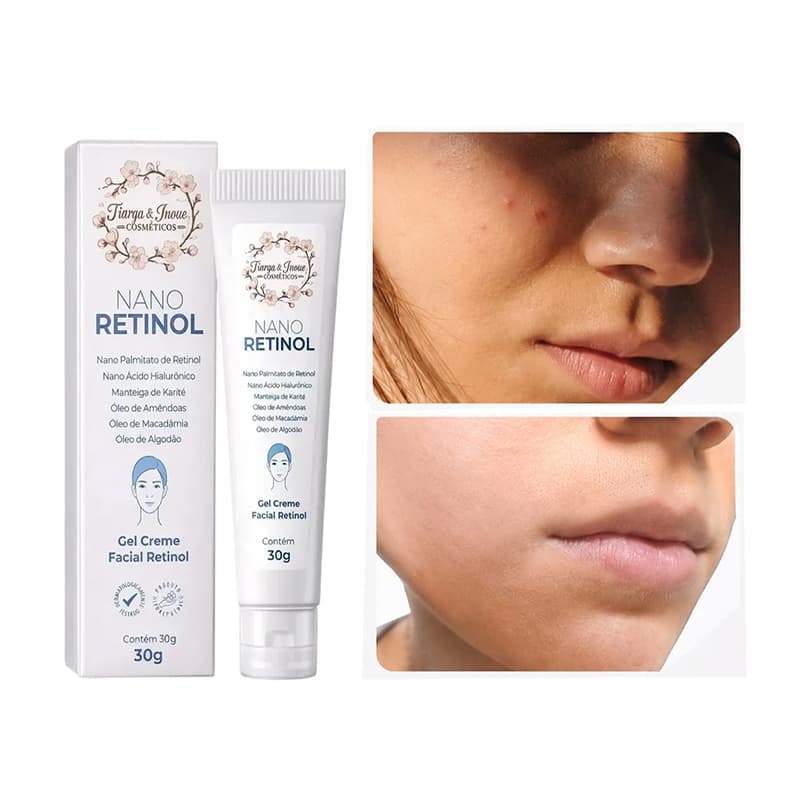 Creme Nano Retinol Fórmula Avançada Anti-idade Rugas Linhas de Expressão 30g