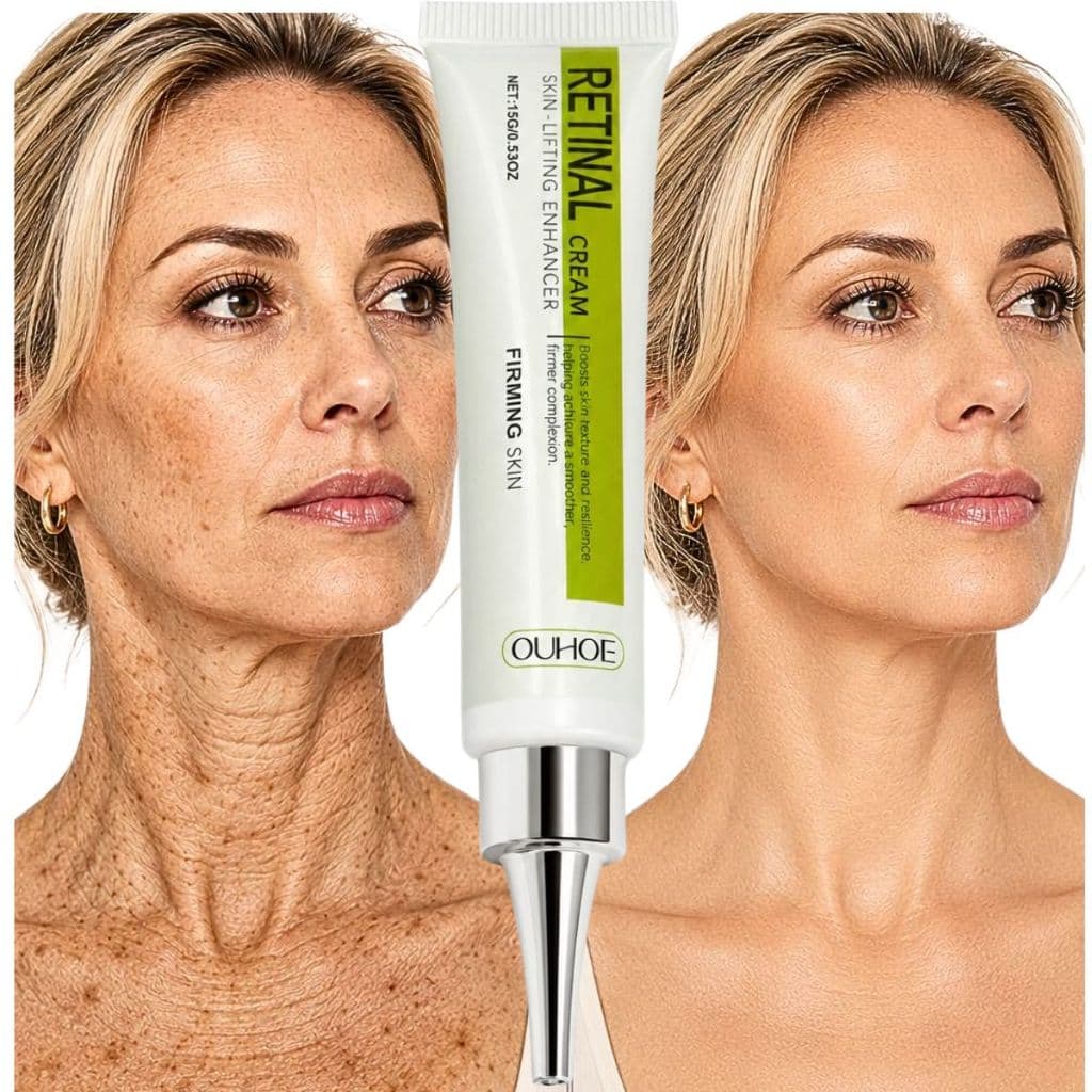 Creme lifting Facial Retinol Ácido Hialurônico Anti-idade Anti Rugas