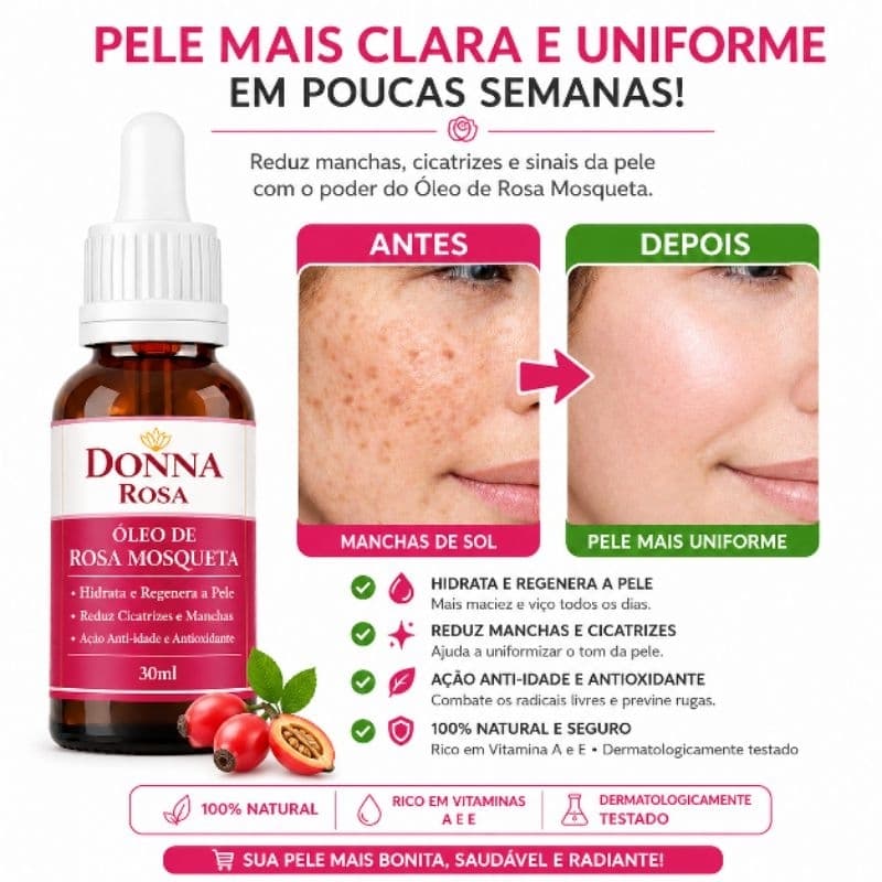 Óleo Rosa Mosqueta Rubiginosa 30ml 100% Puro – Clareador, Anti Manchas, Anti-Idade, Regenerador