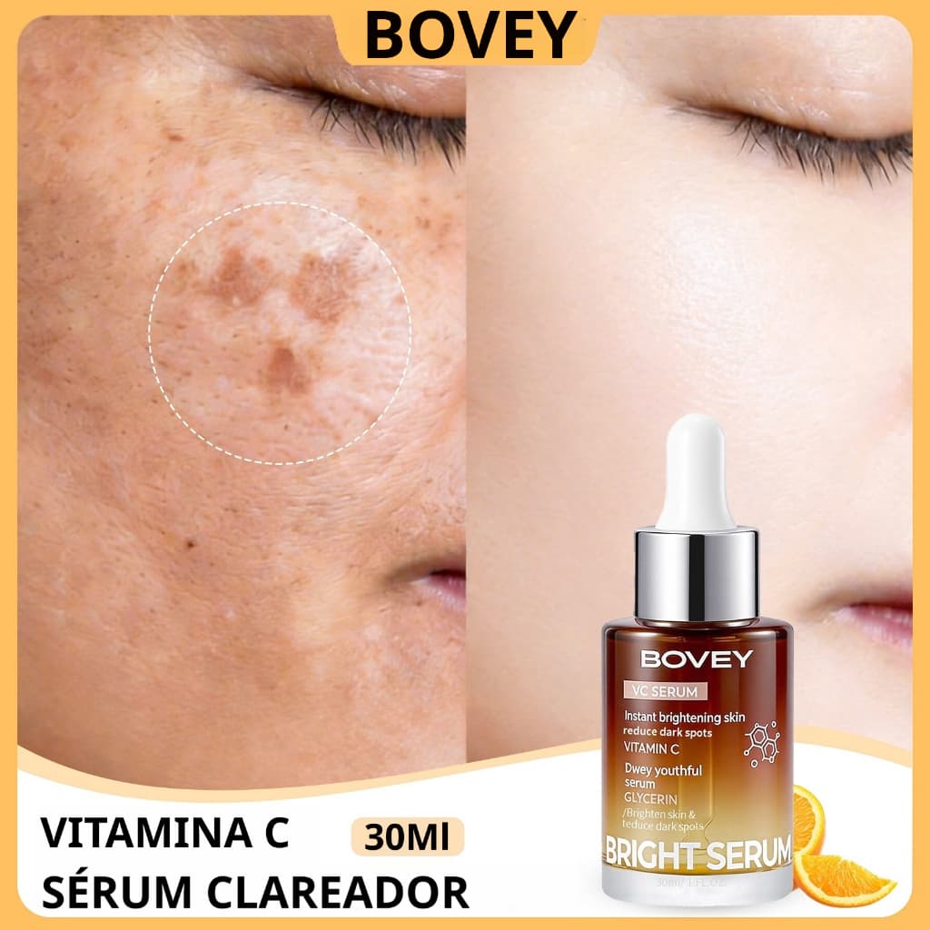 Bovey Vitamina C Soro Facial VC Clareador Antienvelhecimento Sardas Hidratante Para Manchas Escuras 30ml