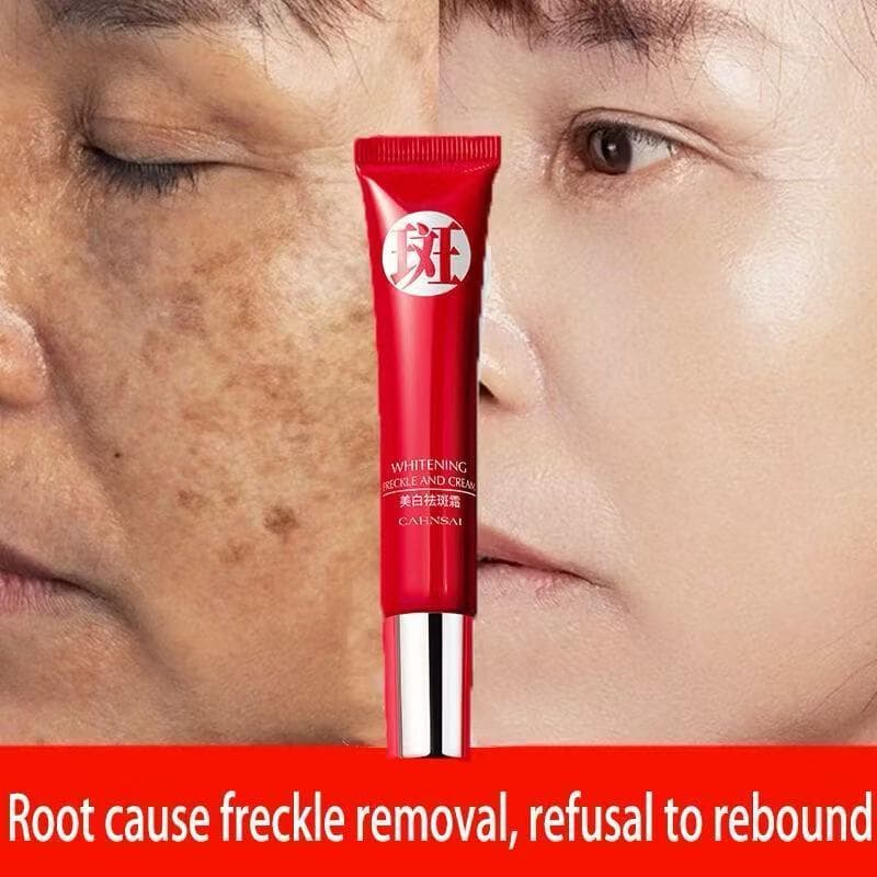 Creme Hidratante Iluminador, Iluminação do Tom da Pele, Clareamento de Olheiras, Aceleração da Produção de Melanina
