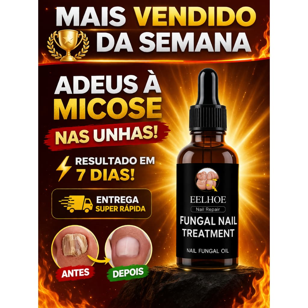 ACABE COM A MICOSE NAS UNHAS RÁPIDO! TRATAMENTO PODEROSO ANTI-FUNGOS + RESULTADOS VISÍVEIS EM DIAS PRETA 30 ml