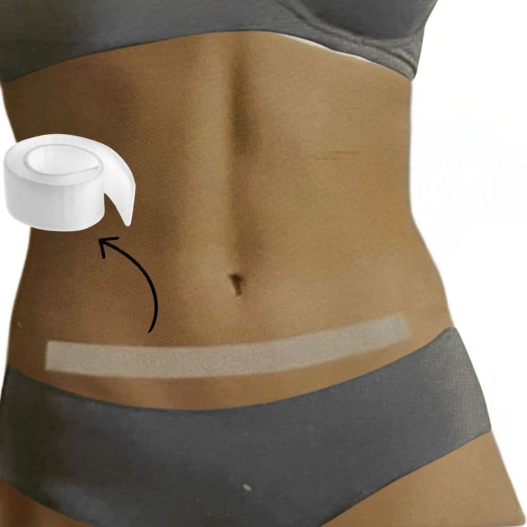 Fita 45x3 cm para Cicatrizes Hipertróficas e Quelóides Siliforma - Fita Silicone Pós cirúrgica