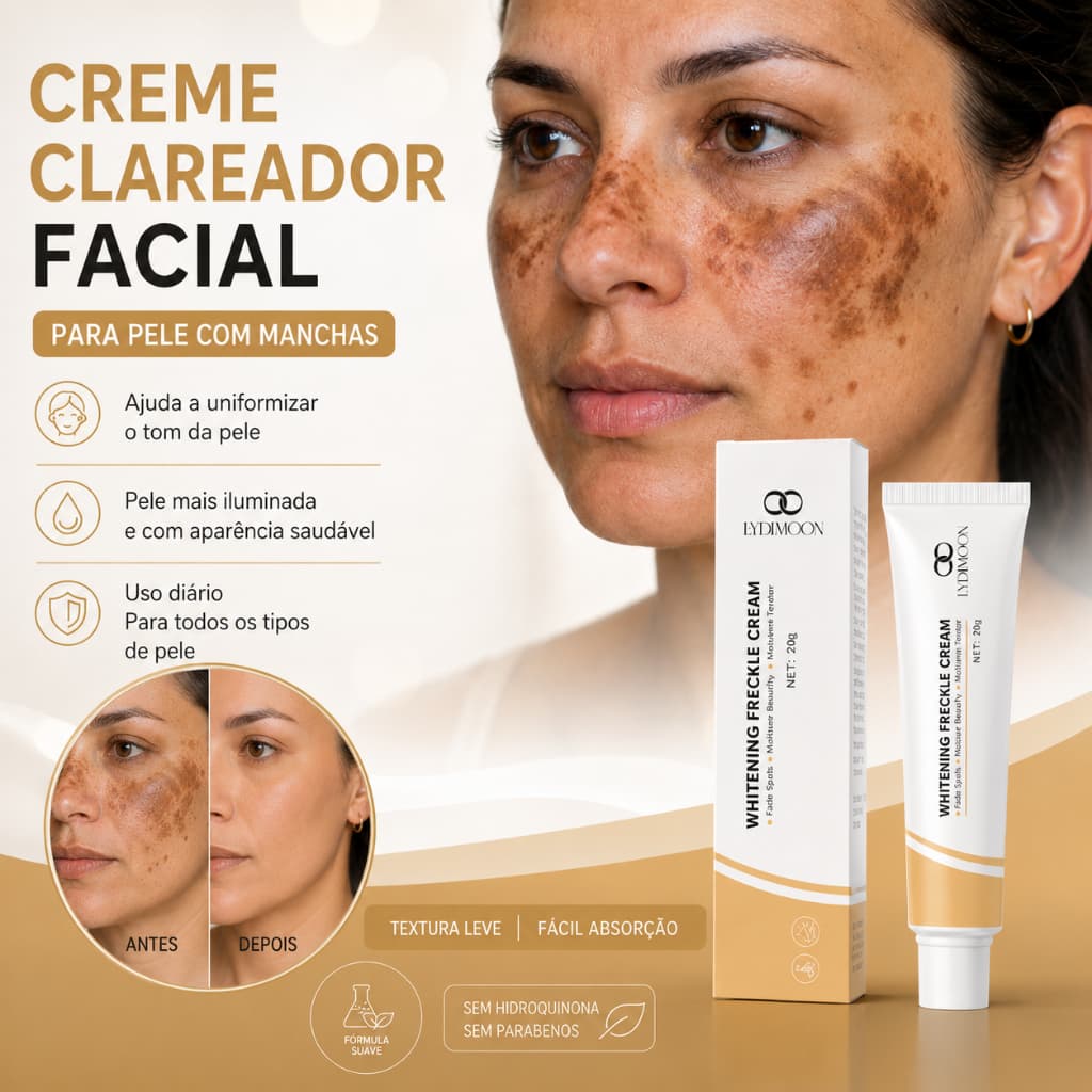Creme Clareador Clareador Facial Creme para Manchas Anti Manchas Melasma Sardas Manchas Solares Manchas de Idade 20g