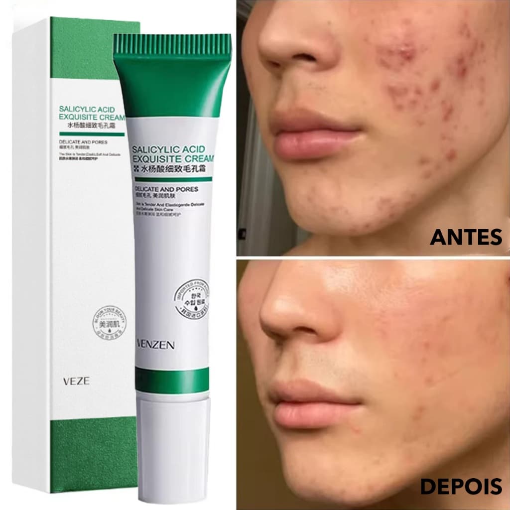 Creme De Ácido Salicílico Para Redução De Poros , Hidratação E Nutrição Da Pele-Hidratante Refinador Loção Facial , Cuid