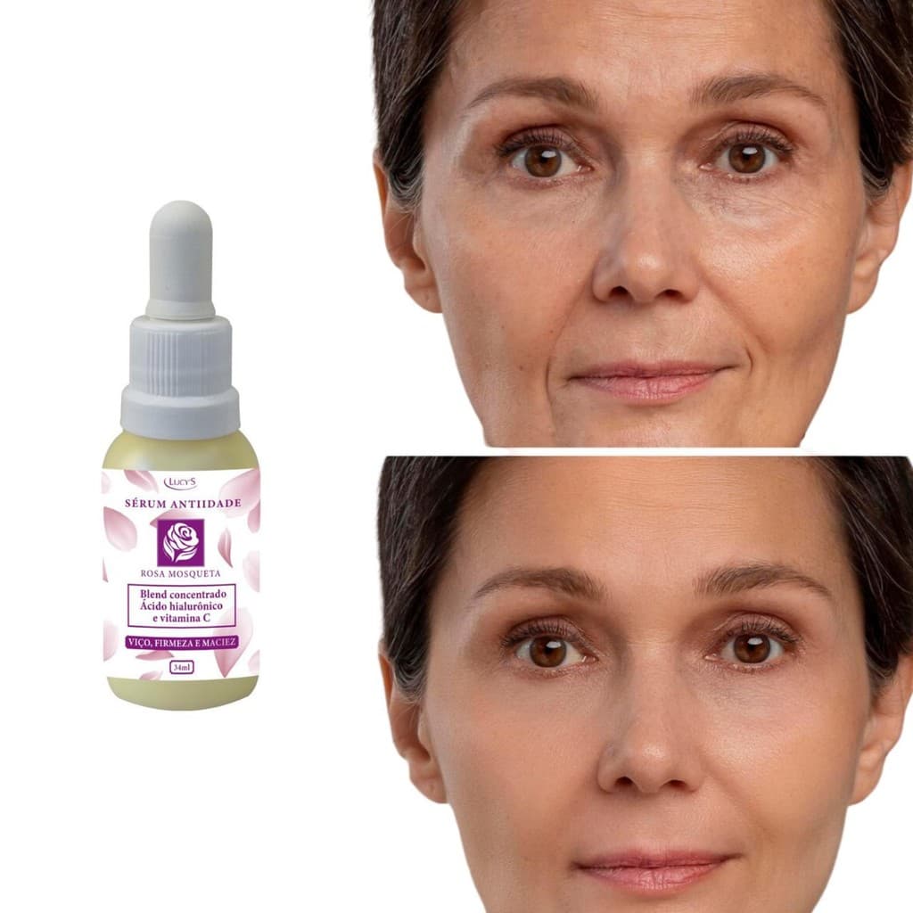 Sérum Rosa Mosqueta Anti Idade Ác. Hialurônico E Vitamina C