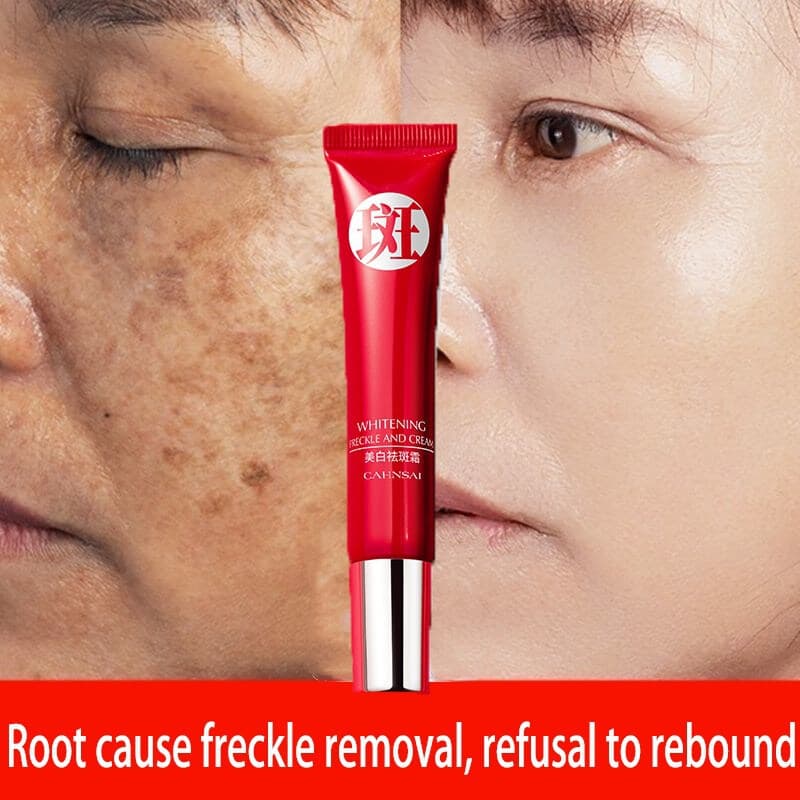 Original Forte Anti-Rugas Poderoso Branqueamento Creme Idade Remoção Dark Points Pigmentação Brilhante Cuidados com a pe