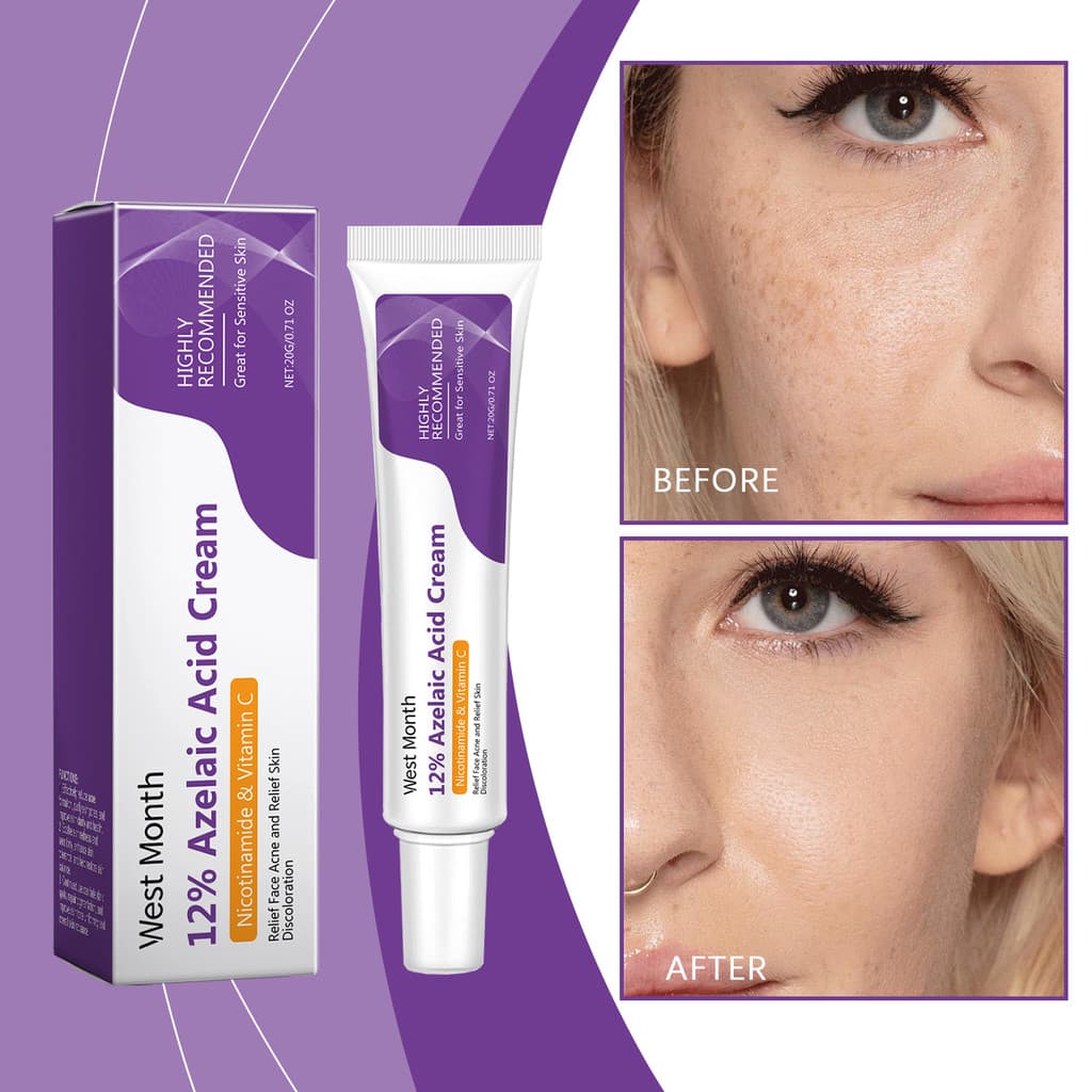 Creme Facial De Ácido Azelaico , Soro 12 % , Niacinamida E Vitamina C-Produtos De Beleza Para