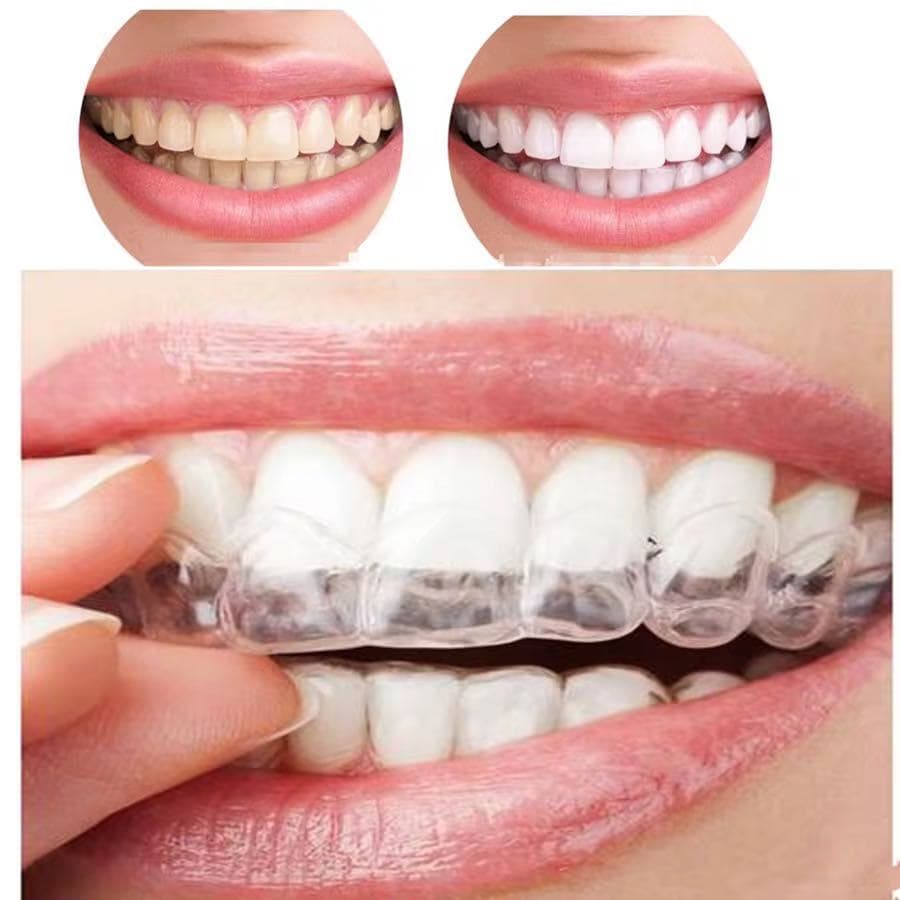 Placa De Silicone Moldável – Ajuste Suave E Conforto Noturno Para Uso Bucal Diário