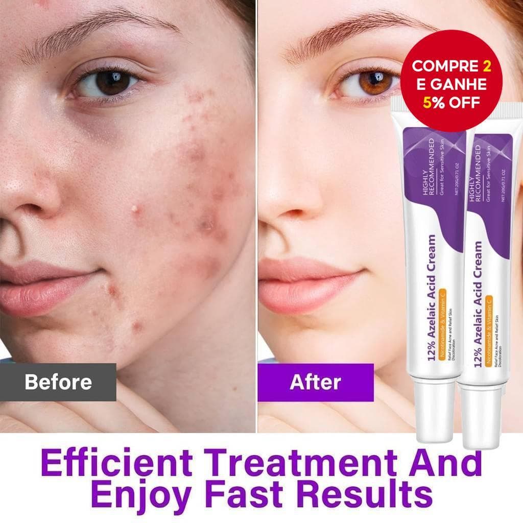 Ácido Azelaico 12 % Creme Facial 20g Niacinamida Vitamina C Iluminador Calmante Cuidados Com A Pele