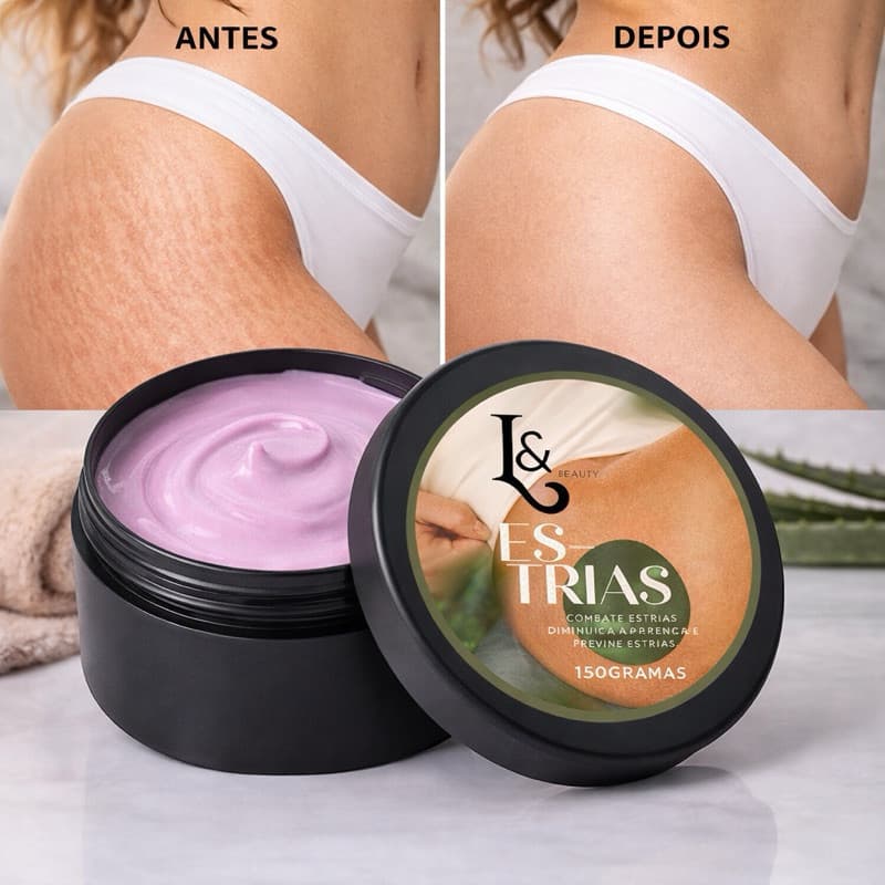 Creme Para Estrias 150g Redutor Clareador Anti Estrias Brancas Vermelhas Hidratante Corporal L&Beauty
