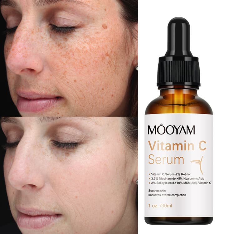 Cuidados com a pele vitamina C essência hidratante vitamina C soro, vitamina C hidratante essência antirrugas