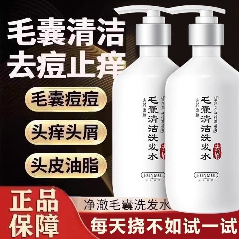 Shampoo de limpeza de folículo capilar anticaspa anti-coceira controle de óleo remoção de ácaros fofo hidratante shampoo