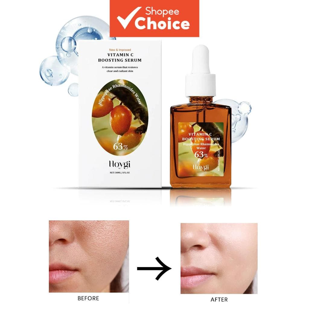 de Vitamina C para Iluminar, Facial para Pele Opaca e com Tom Irregular, Loção Intensificadora de Vitamina C para