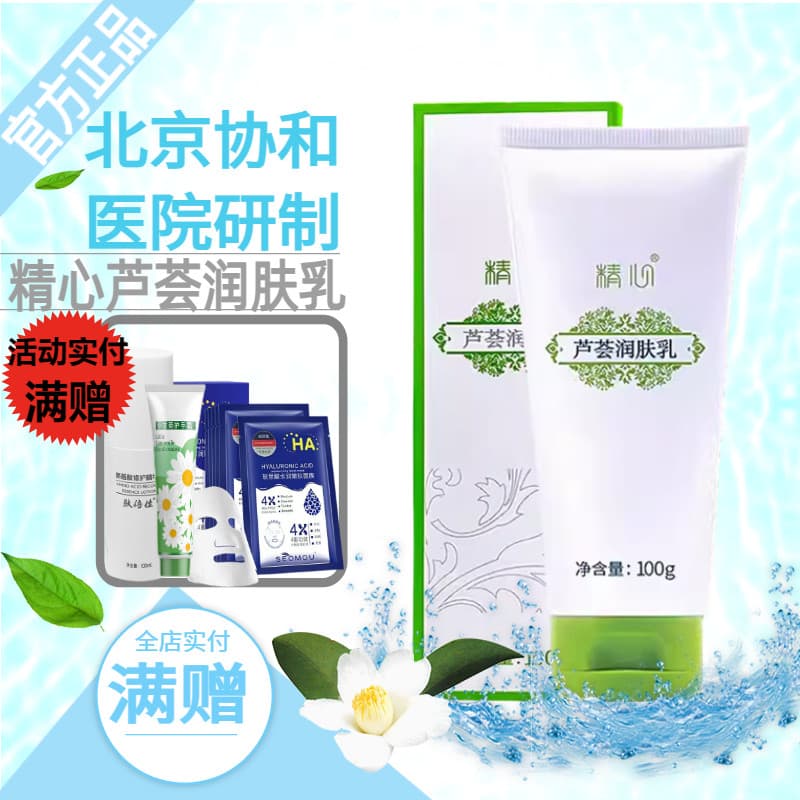 Loção corporal cuidadosa de Aloe Vera, loção Anti-coceira Original, hidratante corporal seco, caspa, hidratante para a p