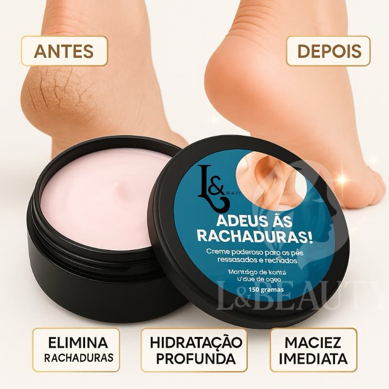 Creme Hidratante para Pés Secos e Ásperos 150g - L&Beauty